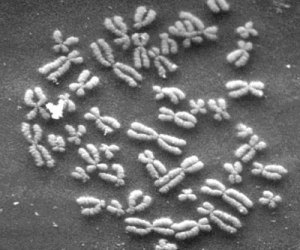 Electron micrograph of chromosomes from Berkeley.