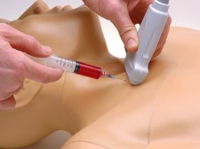 This image (which I found online) shows exactly what we did - use an ultrasound machine to place a needle in the internal jugular vein.